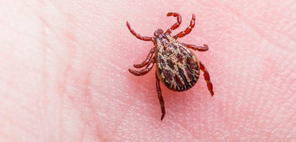 lyme disease